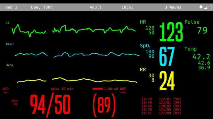 Ati virtual scenario vital signs alfred answers